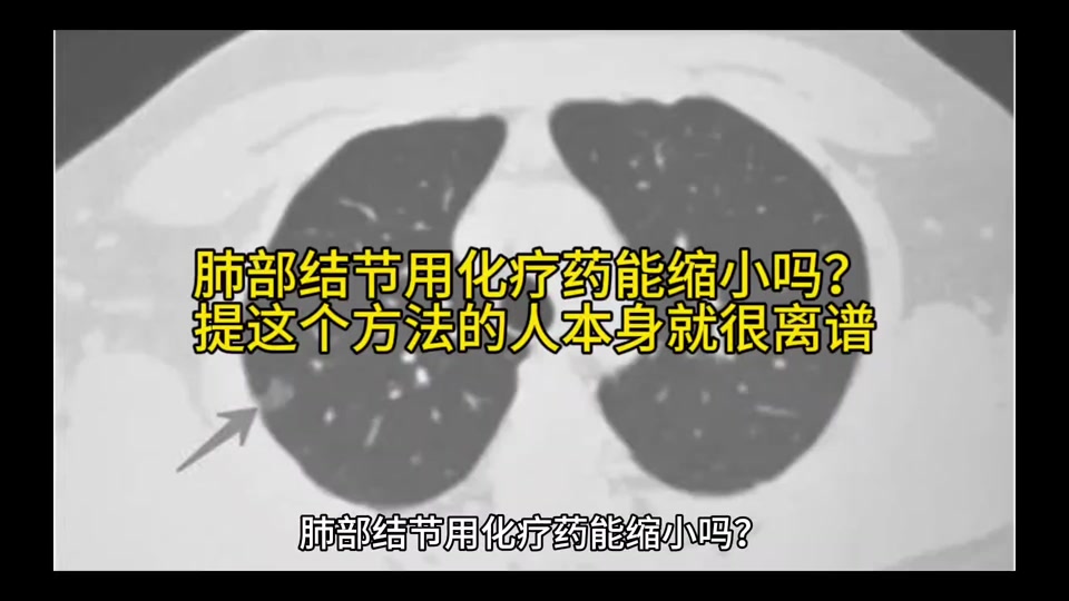 o4F3cFPlrAcSATDBExfbK9vBCTtfIUbcAW9gID?from=876277922&x-expires=2022973200&x-signature=8MoyyD3UFNGHcQ3jmaEYkkCUzg4%3D