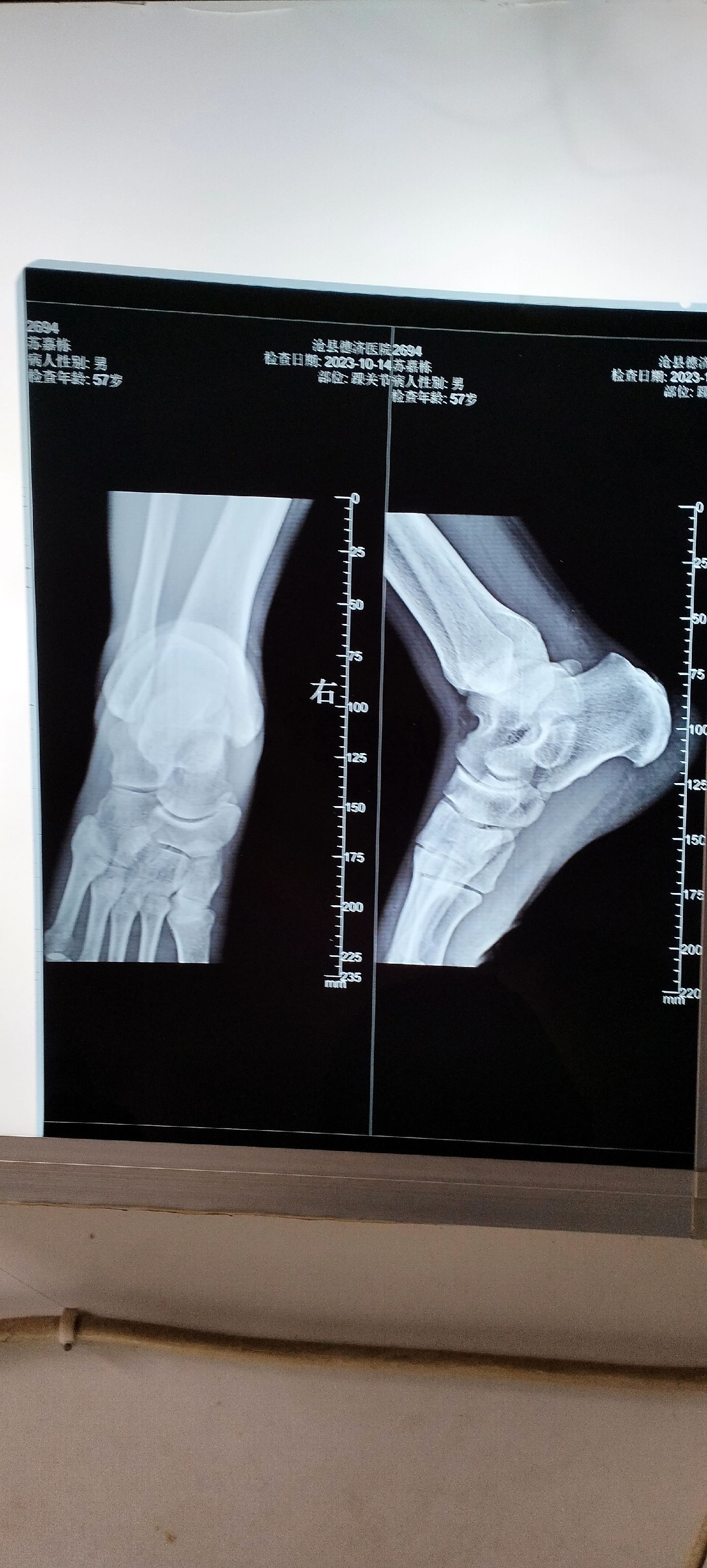 刘氏正骨堂:刘氏正骨堂.祖传接骨 刘银发