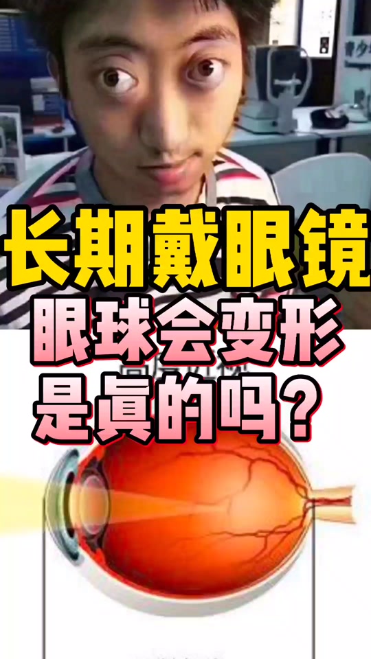 戴眼镜眼睛变形凹陷对比图 - 抖音