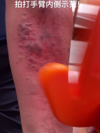 拍打足三里示范 拍打 拍打养生 拍痧板 经络疏通 拍痧神器 抖音 拍打足三里示范 拍打 拍打养生 拍痧板 经络疏通 拍痧神器 抖音