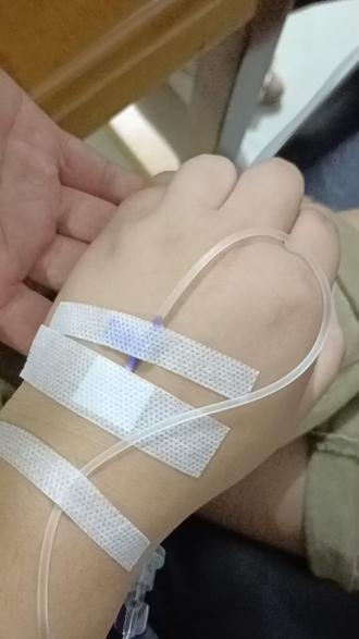 一场突如其来的鼓针让本就胖乎的小手愈发圆润了